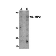 ProSci 4655 LIMP2 Antibody