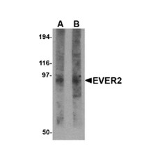 ProSci 4657 EVER2 Antibody