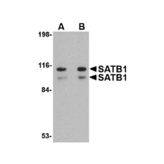 ProSci 4679 SATB1 Antibody