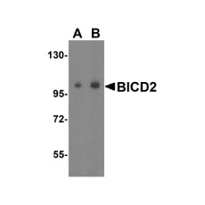 ProSci 4677 BICD2 Antibody