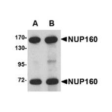 ProSci 4707 NUP160 Antibody