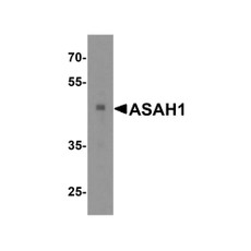 ProSci 4741 ASAH1 Antibody