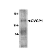 ProSci 4763 OVGP1 Antibody