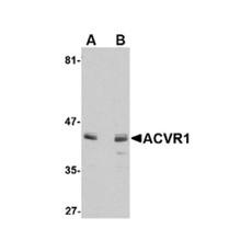 ProSci 4791 ACVR1 Antibody