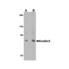 ProSci 4797 KINDLIN3 Antibody