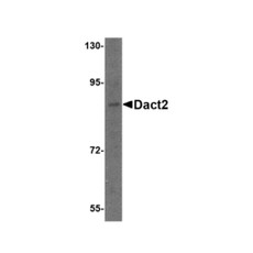 ProSci 4859 Dact2 Antibody
