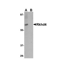 ProSci 4869 Rkhd4 Antibody