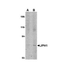ProSci 4917 JPH1 Antibody