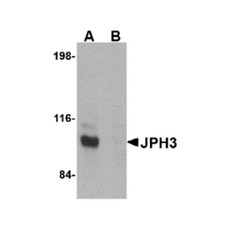ProSci 4921 JPH3 Antibody