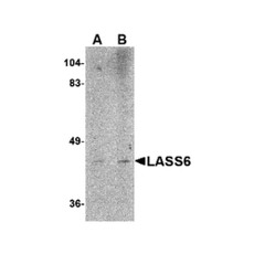 ProSci 4941 LASS6 Antibody