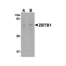 ProSci 4951 ZBTB1 Antibody