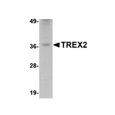 ProSci 4971 TREX2 Antibody