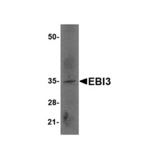 ProSci 4977 EBI3 Antibody