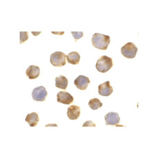 ProSci PM-2016 Apaf-1 Antibody