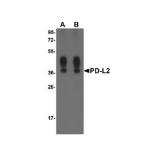 ProSci RF16022 PDL2 Antibody