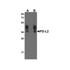 ProSci RF16025 PDL2 Antibody