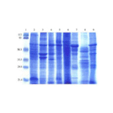 (GS1-174) Human Normal Tissue Blot I ProSci One blot/Unit