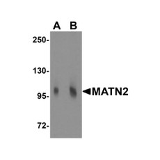 ProSci 5105 MATN2 Antibody