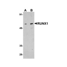 ProSci 5149 RUNX1 Antibody