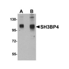 ProSci 5167 SH3BP4 Antibody