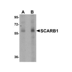 ProSci 5193 SCARB1 Antibody