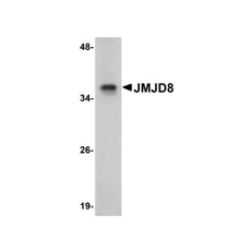 ProSci 5387 JMJD8 Antibody