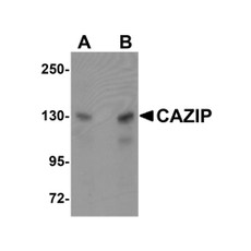ProSci 5639 CAZIP Antibody