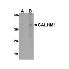 ProSci 5593 CALHM1 Antibody