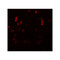 ProSci 5743 PIAS2 Antibody