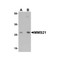 ProSci 5759 MMS21 Antibody