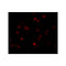 ProSci 5859 CaBP7 Antibody