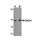 ProSci 5815 FOXO4 Antibody
