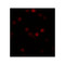 ProSci 5823 SIP1 Antibody