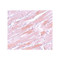 ProSci 5821 IDH2 Antibody