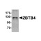 ProSci 6121 ZBTB4 Antibody
