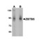 ProSci 6123 ZBTB5 Antibody
