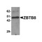 ProSci 6129 ZBTB8 Antibody