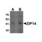 ProSci 6105 ZIP14 Antibody