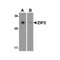 ProSci 6083 ZIP2 Antibody