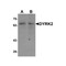 ProSci 6257 DYRK2 Antibody