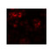 ProSci 6257 DYRK2 Antibody