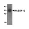 ProSci 6371 RASSF10 Antibody