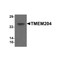 ProSci 6415 TMEM204 Antibody