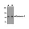 ProSci 6451 Coronin 7 Antibody