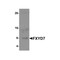 ProSci 6465 FXYD7 Antibody