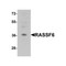 ProSci 6543 RASSF6 Antibody