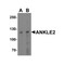 ProSci 6609 ANKLE2 Antibody