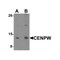 ProSci 6943 CENPW Antibody