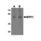 ProSci 7041 WIPI1 Antibody