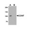 ProSci 7223 CCNT1 Antibody